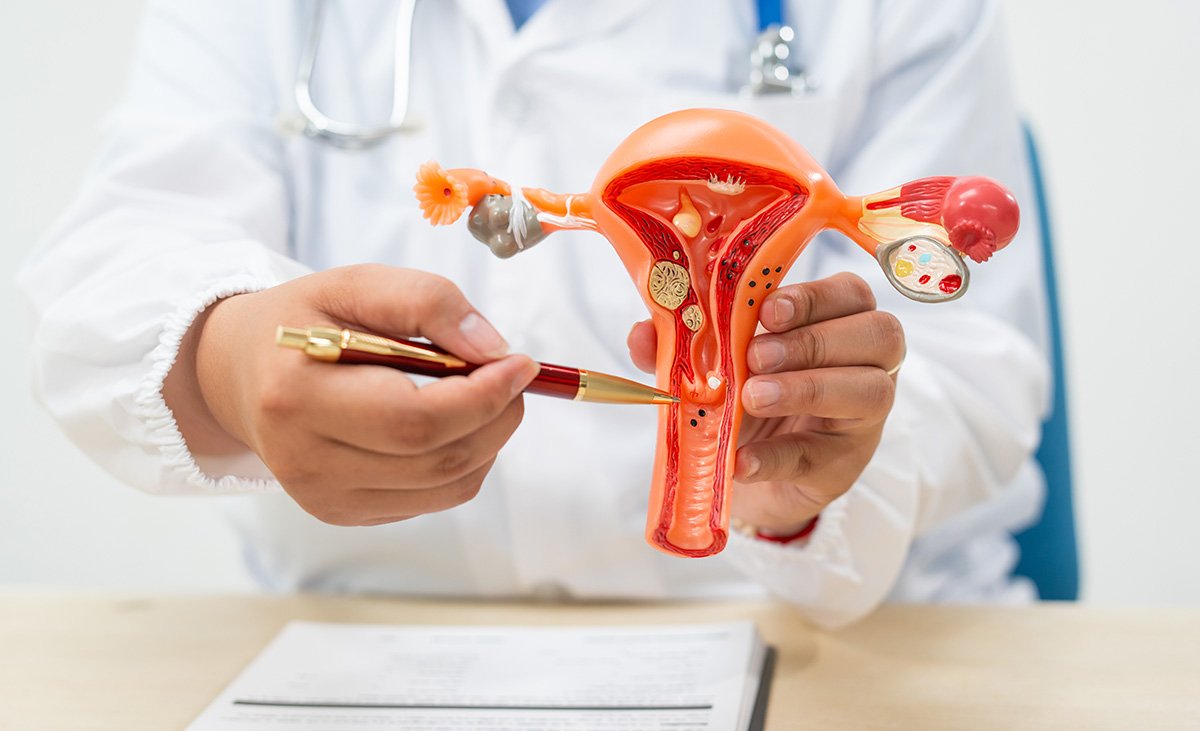 miomatose-uterina-tratamento-cirurgia-especialista